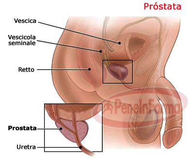 Prostatica cronica: può servire il massaggio prostatico? | Fondazione Umberto Veronesi